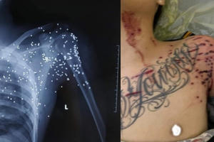 Thái Bình: Nghi phạm nổ súng bắn người ở trạm thu phí Thanh Nê ra đầu thú Thái Bình: Nghi phạm nổ súng bắn người ở trạm thu phí Thanh Nê ra đầu thú