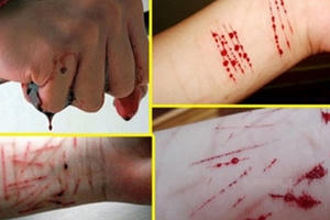 Vì sao học sinh có hành vi tự hủy hoại bản thân?