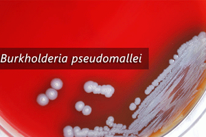 Cảnh giác với căn bệnh nguy hiểm đang bị "lãng quên"