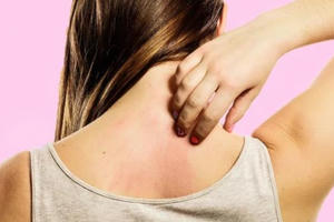 Ngứa ngáy khắp người - dấu hiệu cảnh báo gan đang bị huỷ hoại