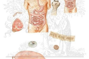 Bệnh sán dây lợn ở người: Hệ luỵ đáng sợ và cách phòng tránh