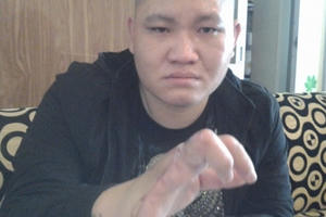 Hà Nội: Nạn nhân bị chém gần cụt bàn tay, Công an huyện vẫn chưa khởi tố vụ án