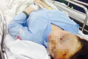 Nữ sinh bị tạt axít ở Sài Gòn viết tâm thư trên Facebook