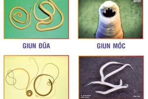 Đừng để giun sán làm tổ trong cơ thể chỉ vì tiếc 20.000 đồng