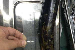 Kinh sợ người đàn ông nhét quả cà tím dài 30cm vào hậu môn để chữa táo bón