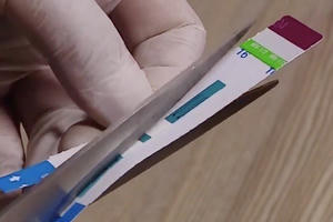 Hà Nội: Công an điều tra vụ cắt đôi test xét nghiệm HIV tại bệnh viện Xanh Pôn