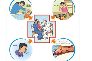 Cảnh báo căn bệnh nguy hiểm viêm não mô cầu tại Hà Nội