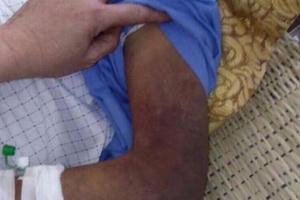 Nghệ An: Con ruột đánh cha gãy xương sườn, toàn thân bầm tím phải nhập viện cấp cứu