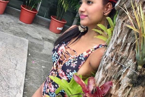 Nghị lực sống mạnh mẽ của cô gái bị điện giật mất 2 cánh tay và 1 chân