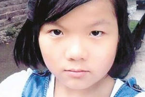 Lao vào lửa cứu cha, bé gái 14 tuổi bị bỏng nặng