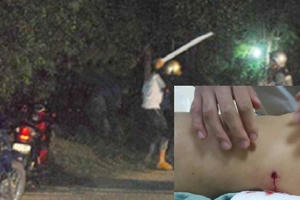 Xác định danh tính đối tượng bắn thủng bụng cô gái đang đi trên đường