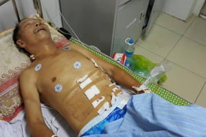 Vụ truy sát hai vợ chồng ở Nghệ An: Sức khỏe nạn nhân dần hồi phục