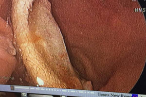 Nam sinh cắt đứt tai của bạn nuốt vào bụng