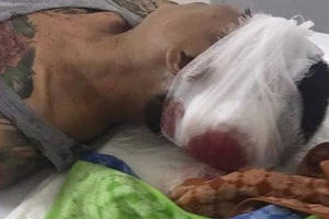 Hà Nội: Hàng chục côn đồ truy sát đuổi đánh hai người gục ngã