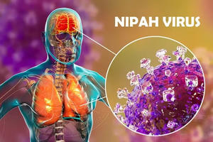 Bộ Y tế tăng cường các biện pháp phòng, chống virus Nipah