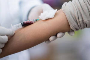 Nhận biết những triệu chứng sớm của HIV