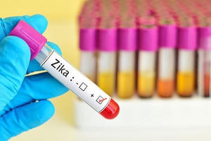 TP HCM: 17/24 quận, huyện ghi nhận sự lưu hành của virus Zika