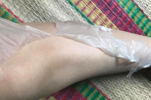 Sự thật mỹ phẩm trắng da hiệu Cozy: Nga Mona Spa lột da, bán mỹ phẩm không nguồn gốc xuất xứ?