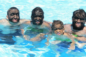 Kỳ lạ một gia đình mắc hội chứng “người sói”