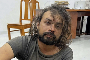 Cảnh sát vượt hàng chục km, rượt đuổi bắt nghi phạm đâm Thiếu tá Công an Cảnh sát vượt hàng chục km, rượt đuổi bắt nghi phạm đâm Thiếu tá Công an