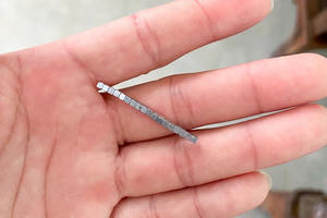 Phát hiện nhiều viên nam châm trong ổ bụng bé 5 tuổi