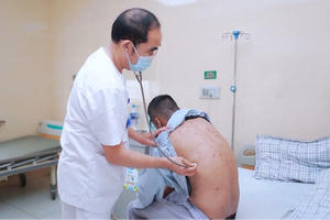 Cẩm Khê (Phú Thọ): Thủy đậu bội nhiễm gia tăng, bác sĩ cảnh báo biến chứng nguy hiểm nếu chủ quan điều trị