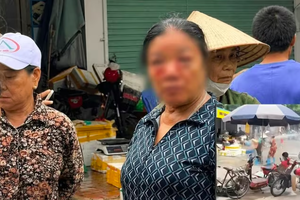 Công an xác minh việc người phụ nữ bán rau bị thương do nước xịt vào mắt gây xôn xao dư luận ở phú Thọ