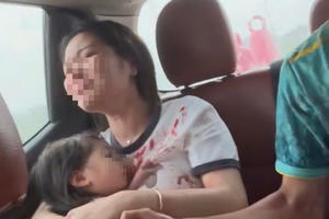 Dùng xe chuyên dụng, CSGT Nghệ An đưa bệnh nhi đi cấp cứu