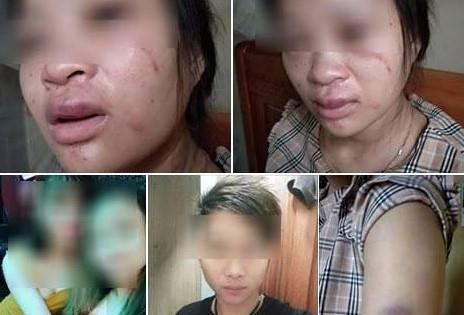 Bị chồng đánh tới tấp dù mang thai sắp sinh vì… mua giày với giá 135.000 đồng?!