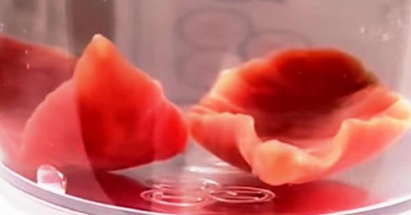 Kinh hoàng ổ sán lá ruột trong tá tràng người phụ nữ ở Nghệ An