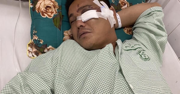 Vụ người đàn ông bị hành hung gãy xương gò má, khâu 28 mũi: Vì sao chưa khởi tố vụ án