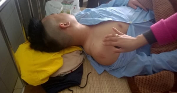 Thanh Hóa: Bị công an đánh "hội đồng", thanh niên nhập viện cấp cứu