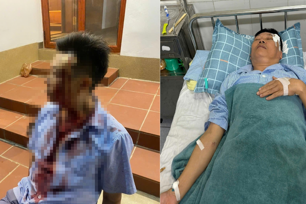 Điều tra, làm rõ việc người đàn ông bị gây thương tích vùng đầu phải nhập viện