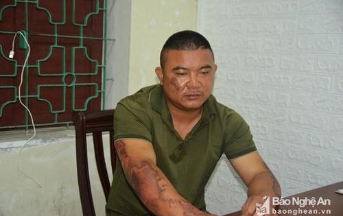 Nghệ An: Đối tượng đốt nhà người yêu có thể chịu hình phạt 20 năm tù?