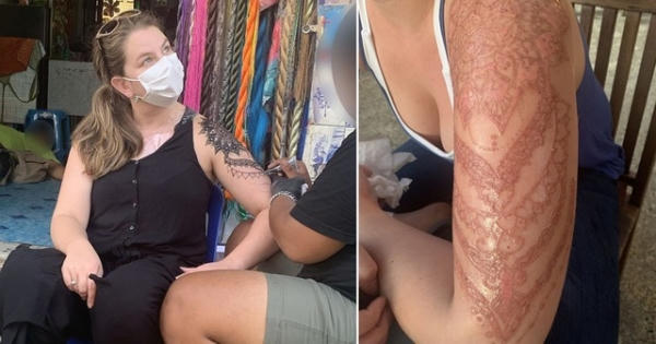 Từ hình xăm kỷ niệm trở thành nỗi ám ảnh kinh hoàng