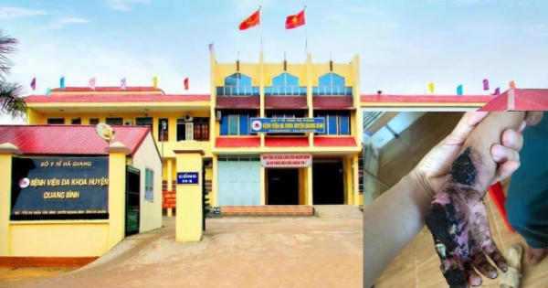 Bé trai 3 tuổi nhập viện do cầm đầu dây điện thoại đang sạc