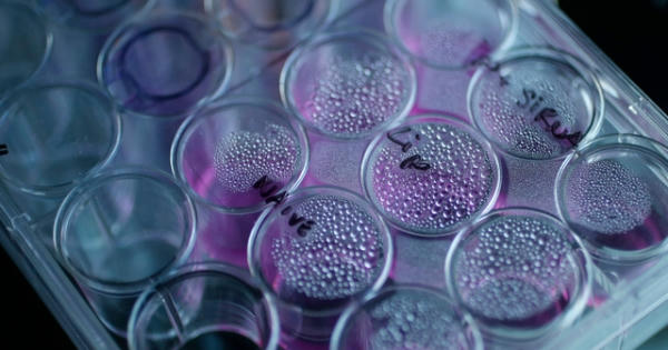 Những hiểu lầm thường gặp về nguyên nhân ung thư