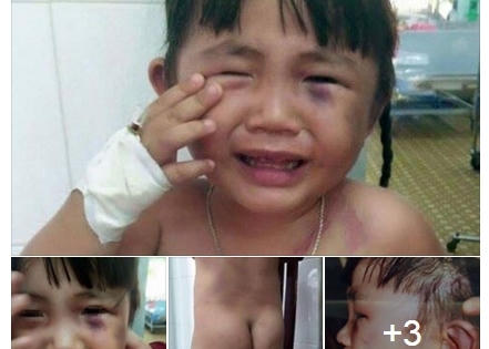 Cha dượng đã bạo hành bé gái 3 tuổi dã man như thế nào?