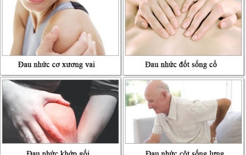 Các vấn đề xương khớp và liệu pháp hiệu quả từ thảo dược Các vấn đề xương khớp và liệu pháp hiệu quả từ thảo dược