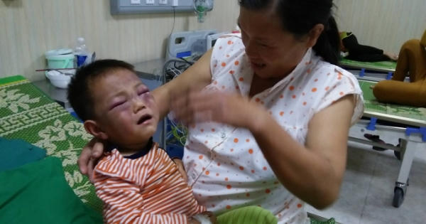 Không truy cứu trách nhiệm hình sự người cha dượng đánh con riêng của vợ nhập viện