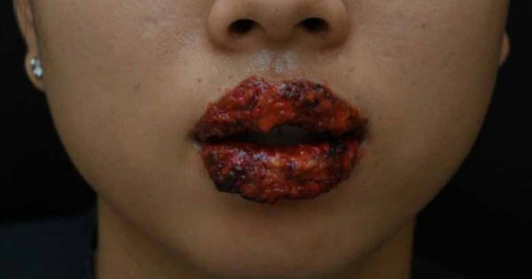 “Suýt” mất môi vì... xăm giá rẻ