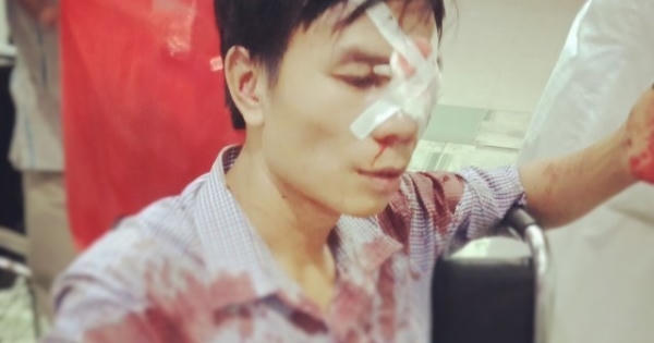 Công an huyện Quỳnh Lưu vào cuộc vụ cán bộ địa chính bị tố đánh gục người sau va chạm giao thông?