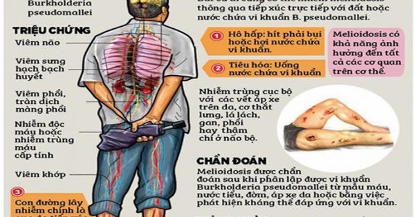Sau hàng chục năm "ngủ quên", virus Whitmore tái xuất ở nhiều địa phương