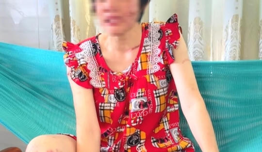 Thai phụ 7 tháng bị chồng bạo hành: Người chồng đã bị Cơ quan công an triệu tập