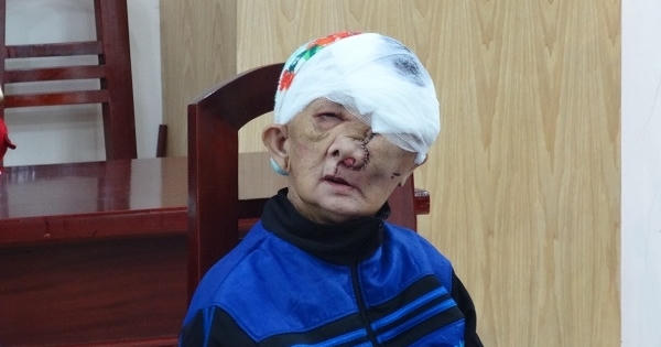 Ca phẫu thuật kỳ diệu lấy đi khối u nặng gần 4kg