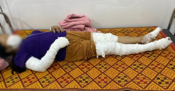 Dựng cây nêu đón Tết, nhóm người bị điện giật cháy xém