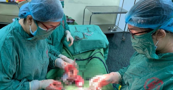 Hy hữu: Sản phụ mang thai đôi ở hai tử cung khác nhau