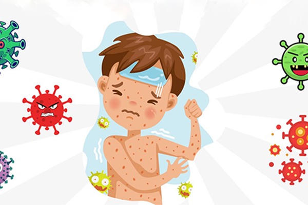 Tuần qua, Hà Nội ghi nhận thêm 189 ca mắc bệnh Sởi