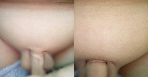 Bé trai bị bố đẻ, mẹ kế tra tấn như thời trung cổ suốt gần 7 năm đến rách cả dương vật