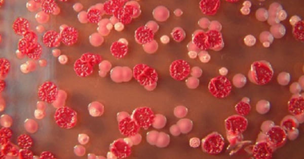 Nhiễm Whitmore nguy hiểm đến mức nào?